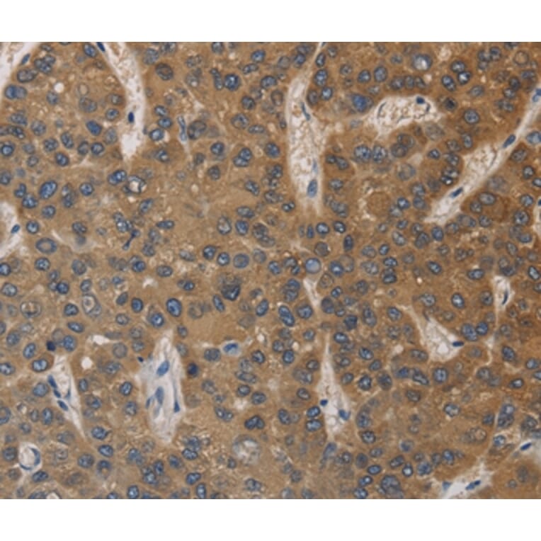 Immunohistochemistry - DEGS1 Antibody from Signalway Antibody (36411) - Antibodies.com