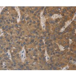 Immunohistochemistry - DEGS1 Antibody from Signalway Antibody (36411) - Antibodies.com