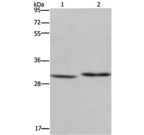 DHRS3 Antibody from Signalway Antibody (36416) - Antibodies.com
