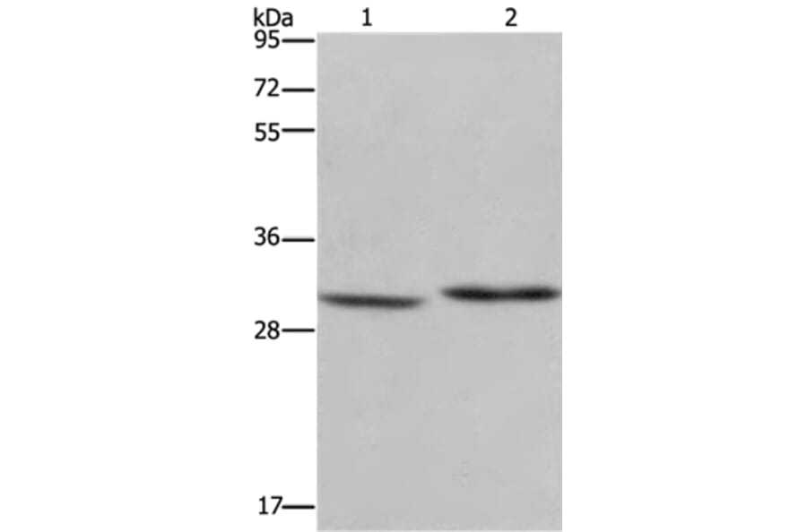 DHRS3 Antibody from Signalway Antibody (36416) - Antibodies.com