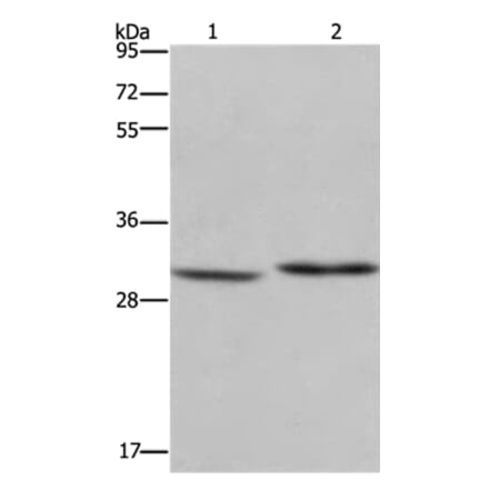 DHRS3 Antibody from Signalway Antibody (36416) - Antibodies.com