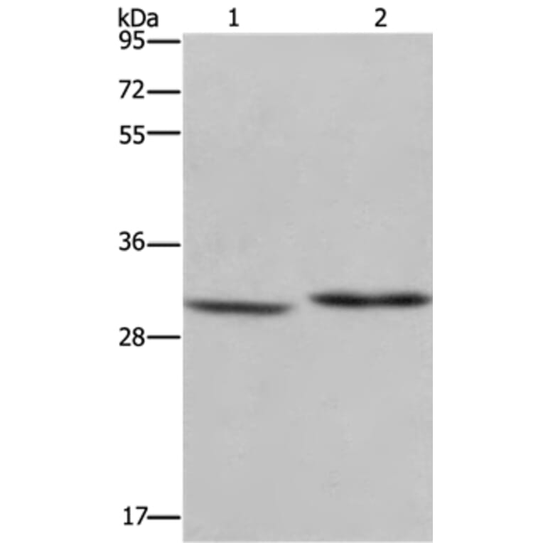 DHRS3 Antibody from Signalway Antibody (36416) - Antibodies.com