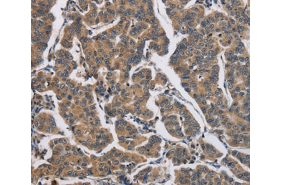 Immunohistochemistry - DHRS3 Antibody from Signalway Antibody (36416) - Antibodies.com