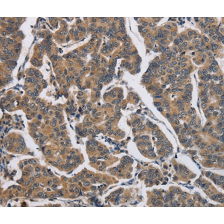 Immunohistochemistry - DHRS3 Antibody from Signalway Antibody (36416) - Antibodies.com