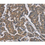 Immunohistochemistry - DHRS3 Antibody from Signalway Antibody (36416) - Antibodies.com