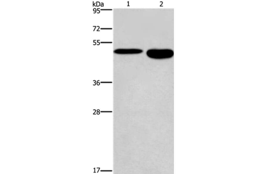DMRT3 Antibody from Signalway Antibody (36419) - Antibodies.com