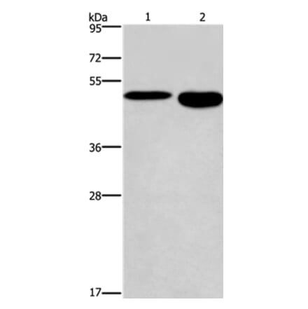 DMRT3 Antibody from Signalway Antibody (36419) - Antibodies.com