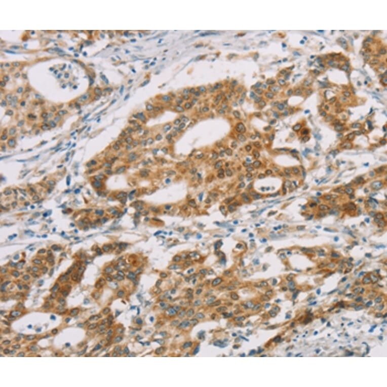 Immunohistochemistry - DMRT3 Antibody from Signalway Antibody (36419) - Antibodies.com
