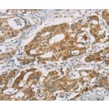 Immunohistochemistry - DMRT3 Antibody from Signalway Antibody (36419) - Antibodies.com
