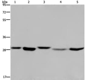 ECHS1 Antibody from Signalway Antibody (36431) - Antibodies.com