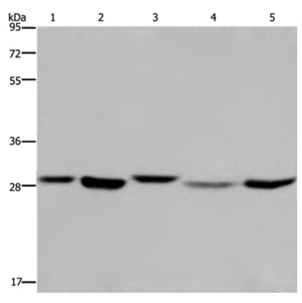 ECHS1 Antibody from Signalway Antibody (36431) - Antibodies.com