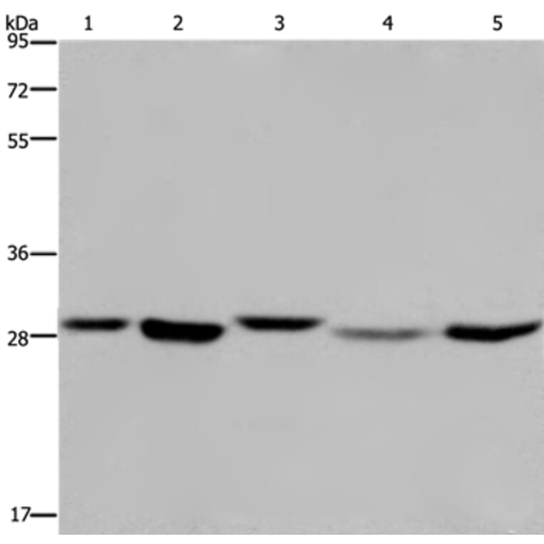 ECHS1 Antibody from Signalway Antibody (36431) - Antibodies.com