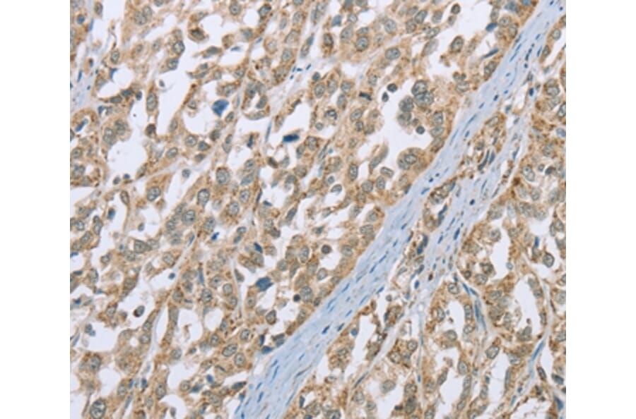 Immunohistochemistry - ECHS1 Antibody from Signalway Antibody (36431) - Antibodies.com