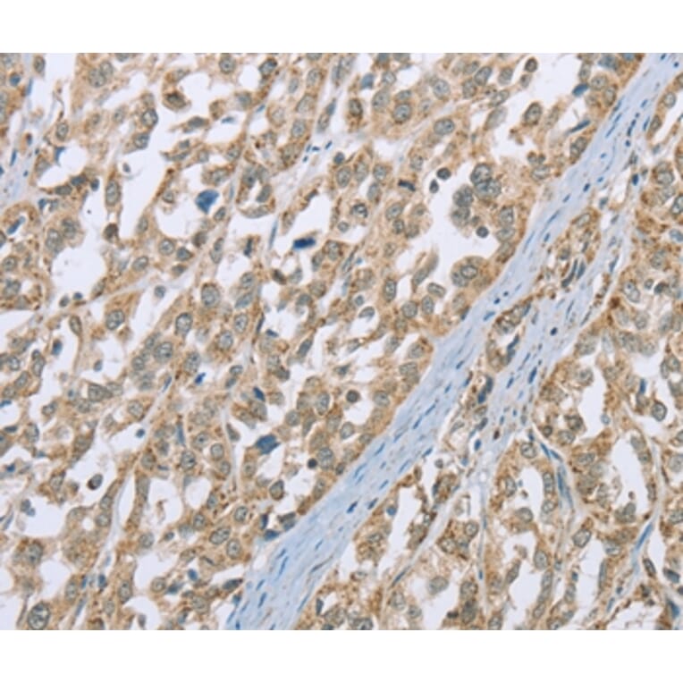 Immunohistochemistry - ECHS1 Antibody from Signalway Antibody (36431) - Antibodies.com