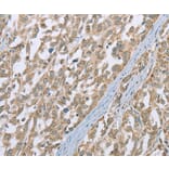 Immunohistochemistry - ECHS1 Antibody from Signalway Antibody (36431) - Antibodies.com