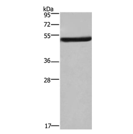 EIF3F Antibody from Signalway Antibody (36438) - Antibodies.com