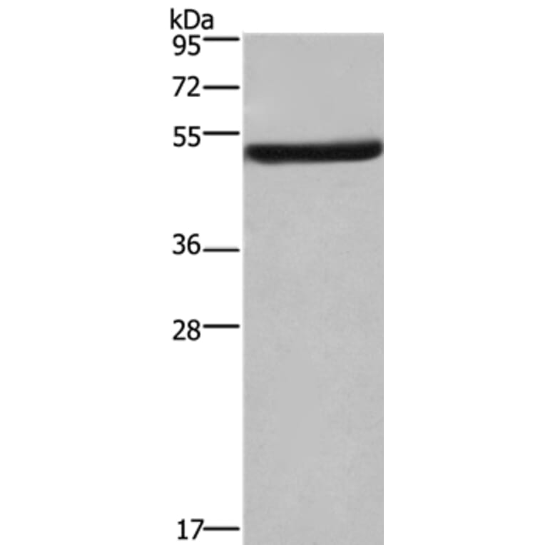 EIF3F Antibody from Signalway Antibody (36438) - Antibodies.com