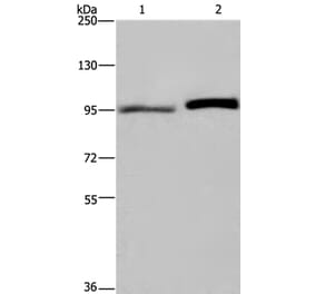 ELAC2 Antibody from Signalway Antibody (36441) - Antibodies.com