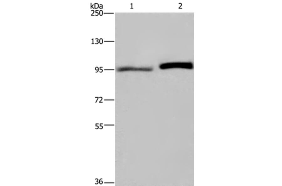 ELAC2 Antibody from Signalway Antibody (36441) - Antibodies.com