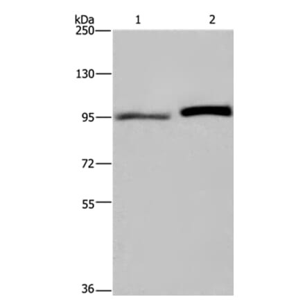 ELAC2 Antibody from Signalway Antibody (36441) - Antibodies.com