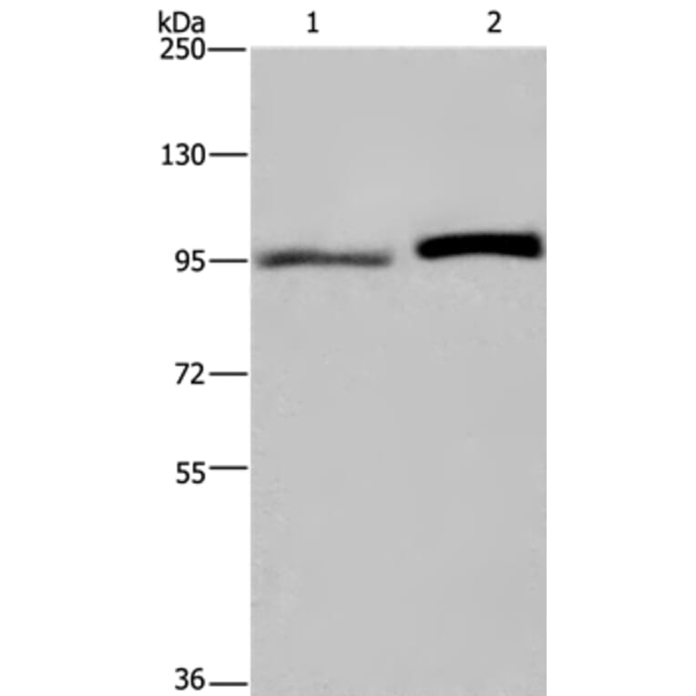 ELAC2 Antibody from Signalway Antibody (36441) - Antibodies.com