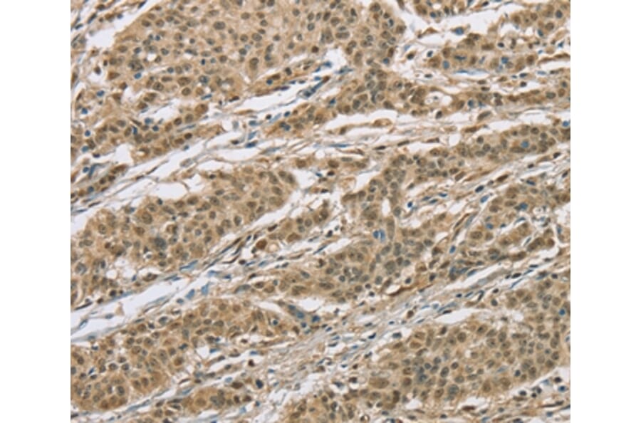 Immunohistochemistry - ELAC2 Antibody from Signalway Antibody (36441) - Antibodies.com
