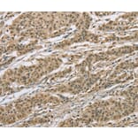 Immunohistochemistry - ELAC2 Antibody from Signalway Antibody (36441) - Antibodies.com