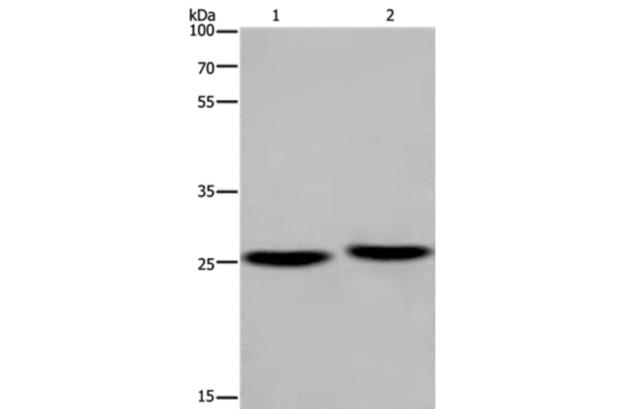 EPDR1 Antibody from Signalway Antibody (36444) - Antibodies.com