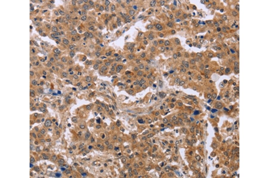 Immunohistochemistry - EPDR1 Antibody from Signalway Antibody (36444) - Antibodies.com