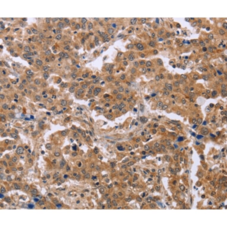 Immunohistochemistry - EPDR1 Antibody from Signalway Antibody (36444) - Antibodies.com