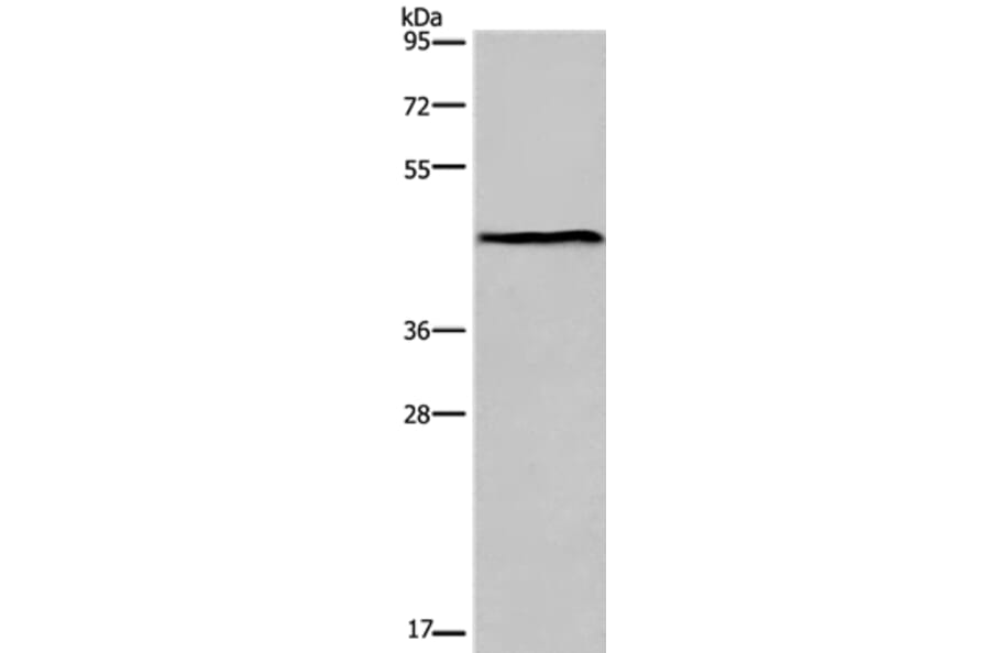 ESRRG Antibody from Signalway Antibody (36449) - Antibodies.com