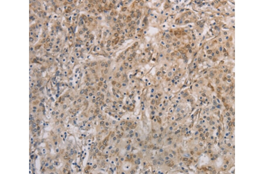 Immunohistochemistry - ESRRG Antibody from Signalway Antibody (36449) - Antibodies.com