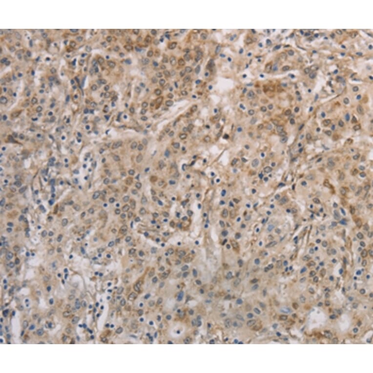 Immunohistochemistry - ESRRG Antibody from Signalway Antibody (36449) - Antibodies.com