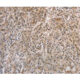 Immunohistochemistry - ESRRG Antibody from Signalway Antibody (36449) - Antibodies.com
