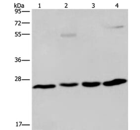 ETHE1 Antibody from Signalway Antibody (36450) - Antibodies.com