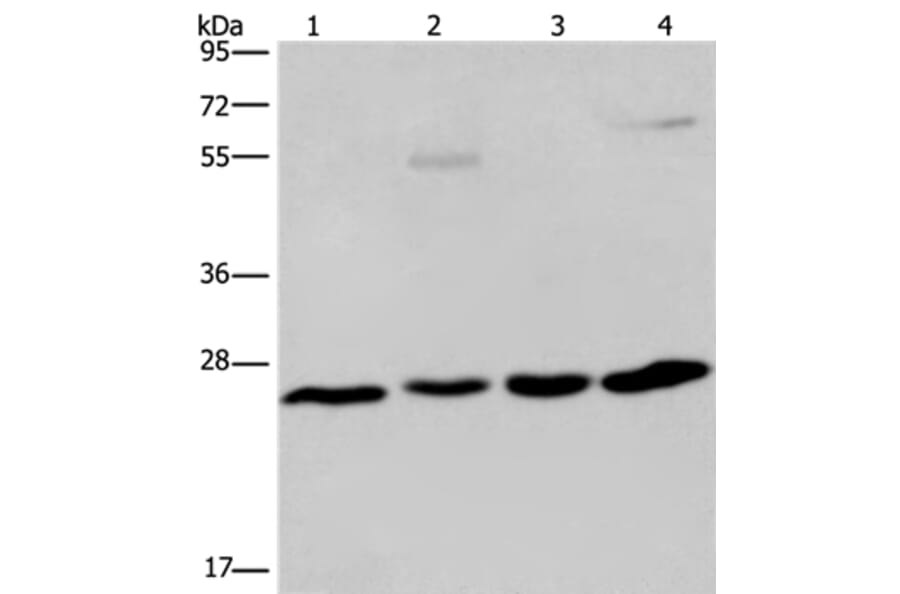 ETHE1 Antibody from Signalway Antibody (36450) - Antibodies.com