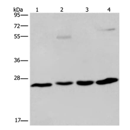 ETHE1 Antibody from Signalway Antibody (36450) - Antibodies.com