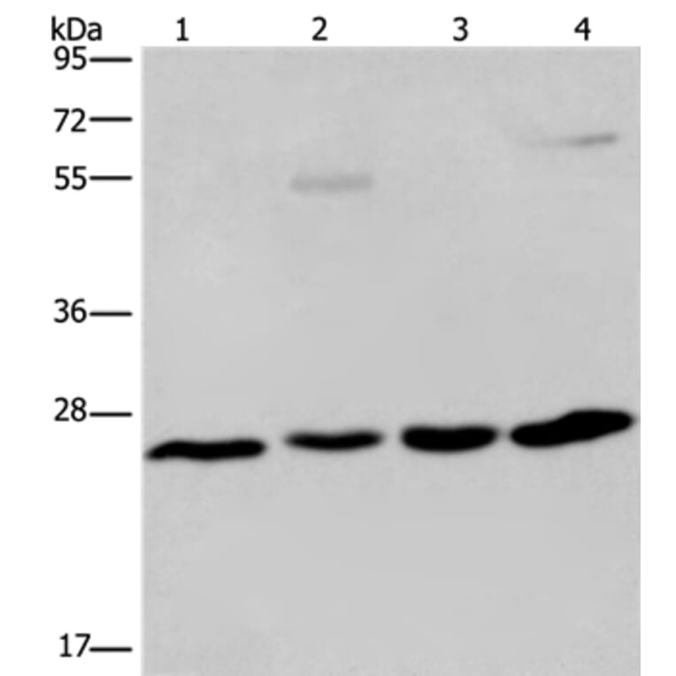 ETHE1 Antibody from Signalway Antibody (36450) - Antibodies.com