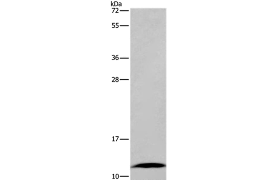 FABP6 Antibody from Signalway Antibody (36456) - Antibodies.com