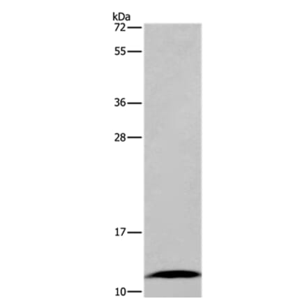 FABP6 Antibody from Signalway Antibody (36456) - Antibodies.com