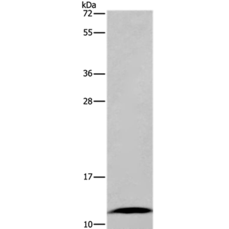 FABP6 Antibody from Signalway Antibody (36456) - Antibodies.com