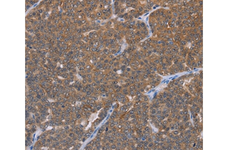 Immunohistochemistry - FABP6 Antibody from Signalway Antibody (36456) - Antibodies.com