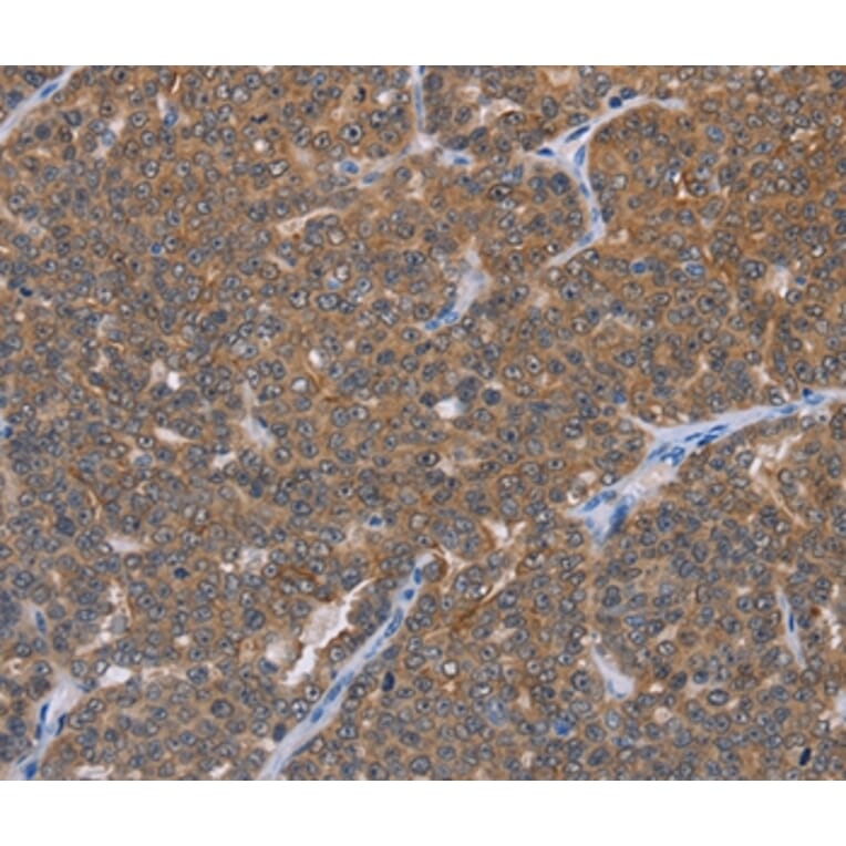 Immunohistochemistry - FABP6 Antibody from Signalway Antibody (36456) - Antibodies.com