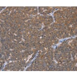 Immunohistochemistry - FABP6 Antibody from Signalway Antibody (36456) - Antibodies.com