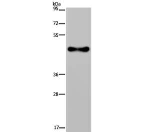 FADS1 Antibody from Signalway Antibody (36457) - Antibodies.com