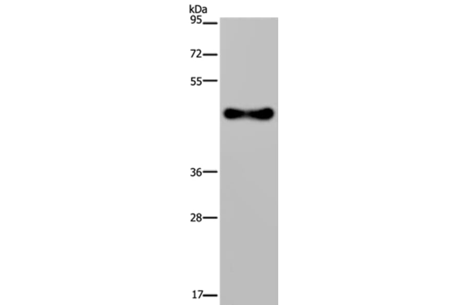 FADS1 Antibody from Signalway Antibody (36457) - Antibodies.com