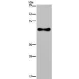 FADS1 Antibody from Signalway Antibody (36457) - Antibodies.com