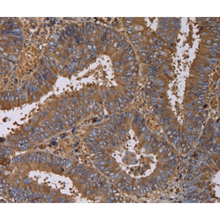 Immunohistochemistry - FADS1 Antibody from Signalway Antibody (36457) - Antibodies.com