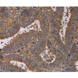 Immunohistochemistry - FADS1 Antibody from Signalway Antibody (36457) - Antibodies.com