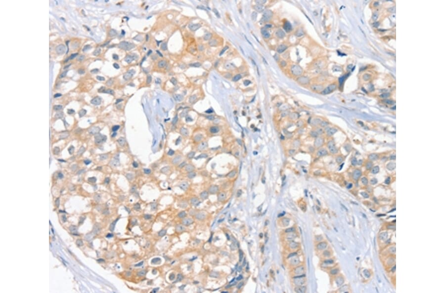 Immunohistochemistry - FAIM3 Antibody from Signalway Antibody (36458) - Antibodies.com